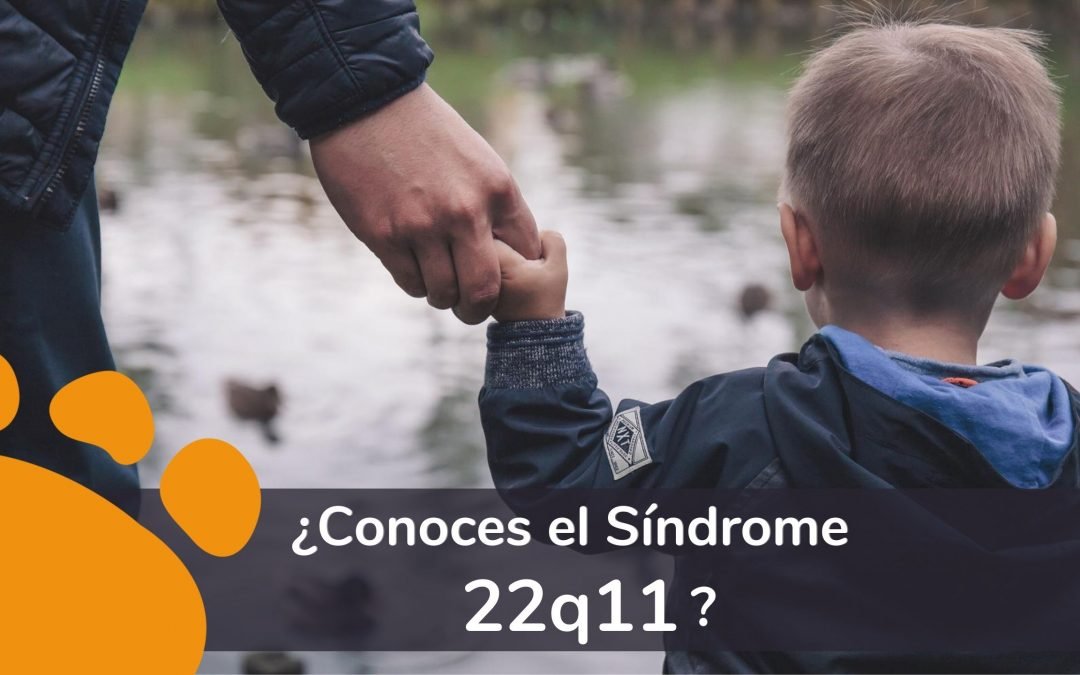 ¿Conoces el Síndrome 22q11?